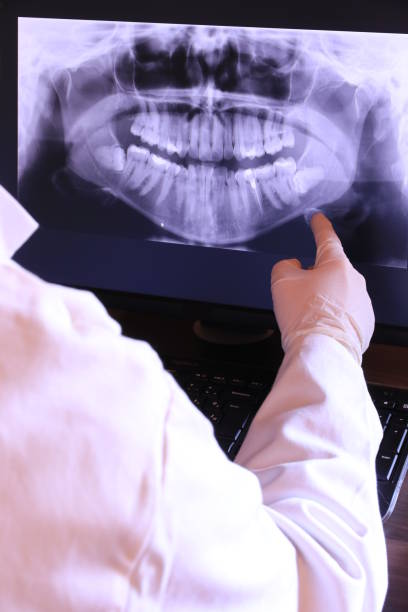 Best Emergency Dentist for Special Needs Patients in Mill Valley, CA