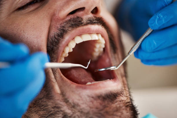 Best Emergency Cosmetic Dentistry in Mill Valley, CA